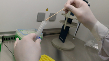 Φάρμακα για τον κορωνοϊό: Ελπίδα για την αντιμετώπιση της φλεγμονώδους «καταιγίδας»