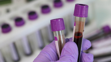 ΠΟΥ: Είναι πιθανόν να μην υπάρξει ποτέ θεραπεία για τον κορωνοϊό