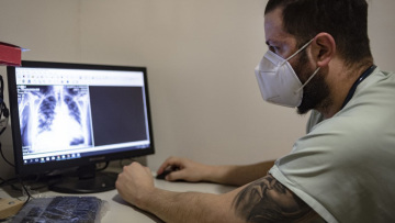 Κορωνοϊός: Ακτινογραφία-σοκ με τη ραγδαία επιδείνωση στους πνεύμονες 38χρονου ασθενή