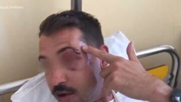 Γκάζι: Άγριος ξυλοδαρμός 33χρονου για ένα κινητό - Βίντεο-ντοκουμέντο από το νοσοκομείο 