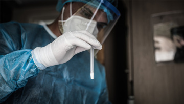 Σπάει το ένα αρνητικό ρεκόρ μετά το άλλο ο κορωνοϊός – Τις επόμενες 10 ημέρες κρίνονται τα μέτρα