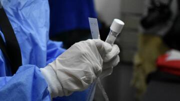 Κορωνοϊός: Το πανεπιστήμιο της Οξφόρδης ετοιμάζει «πεντάλεπτο» τεστ 