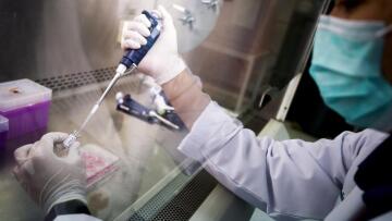 Νέα μελέτη για την υδροξυχλωροκίνη: Aυξάνει την πιθανότητα θανάτου των ασθενών με κορωνοϊό 