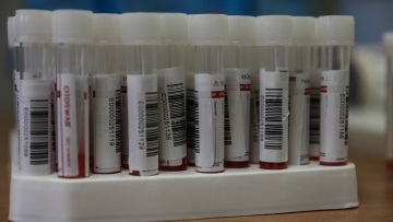 Βρετανία: Στα 23.254 τα νέα κρούσματα κορωνοϊού 