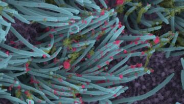 Κορωνοϊός: Δείτε φωτογραφίες πώς προσβάλλει τα κύτταρα του αναπνευστικού 