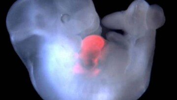 Έρευνα: Βρέθηκαν... μικροπλαστικά σε πλακούντα γυναικών