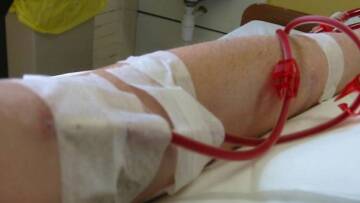 Τραγικό τέλος για 60χρονη στον Πύργο: Tράβηξε κατά λάθος τα καλώδια της αιμοκάθαρσης