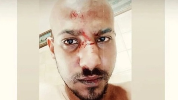 Ναύπακτος: Ξυλοκόπησαν νεαρό και τον παράτησαν αιμόφυρτο