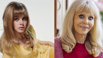 Μπριτ Έκλαντ: Το πρώην «κορίτσι του Τζέιμς Μποντ» μετανιώνει για τα fillers χειλιών που «κατέστρεψαν το πρόσωπό της»