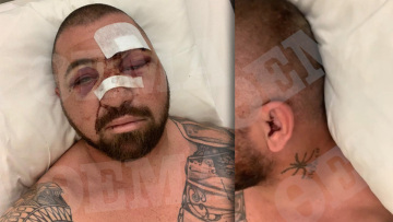 Ο σωματοφύλακας του Νταν Μπιλζέριαν στο protothema.gr: «Eίμαι τυχερός που ζω, με λιθοβολούσαν με μεγάλες πέτρες»