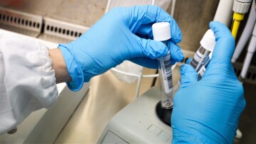 Κορωνοϊός - Λύματα: Εκρηκτική αύξηση του ιικού φορτίου 219% στην Αττική και 260% στη Θεσσαλονίκη