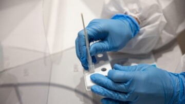 Έρευνα: Η σοβαρή Covid-19 μπορεί να γυρίσει μπούμερανγκ το ανοσοποιητικό σε βάθος χρόνου