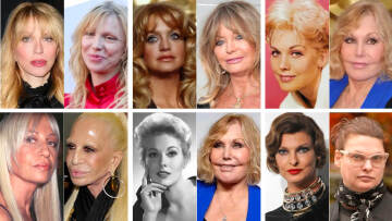 Ποιες διάσημες παραμορφώθηκαν μετά από πλαστικές επεμβάσεις