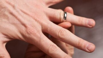 Πυροσβέστες έσωσαν το δάχτυλο κοπέλας από κολλημένη βέρα στη Λάρισα