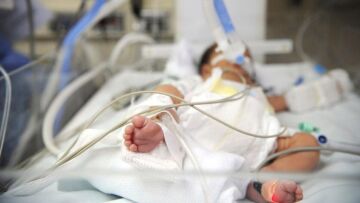 Θεσσαλονίκη: Διασωληνώθηκε βρέφος 4 μηνών που νοσεί με κορωνοϊό