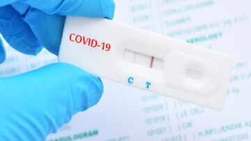 Πιστοποιητικό νόσησης: Να μειωθεί στους τρεις μήνες η διάρκειά του εισηγούνται οι ειδικοί