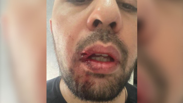 Καταγγελία βιασμού στη Θεσσαλονίκη: «Μου είχαν κλέψει το κινητό» λέει ένας εμπλεκόμενος που είχε κάνει ανάρτηση για το συμβάν