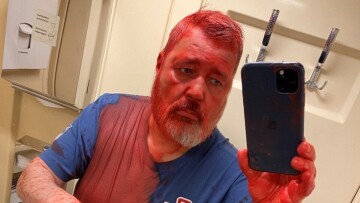 ΗΠΑ: Ρωσικές μυστικές υπηρεσίες πίσω από την επίθεση στον Μουράτοφ