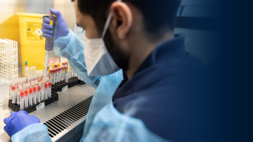 «Καμπανάκι» από ΠΟΥ: Η εξάπλωση της ευλογιάς των πιθήκων ίσως επιταχυνθεί το καλοκαίρι