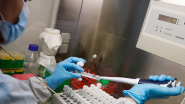 Ευλογιά των πιθήκων: Τα ύποπτα συμπτώματα του ιού σύμφωνα με τον ΕΟΔΥ