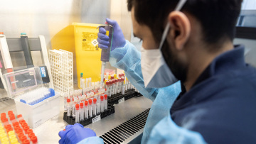 Ευλογιά των πιθήκων: Ποιοι πρέπει να εμβολιαστούν, πότε και με ποιο εμβόλιο