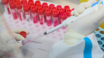 Ευλογιά των πιθήκων: Τα τέσσερα βασικά και αναπάντητα έως τώρα ερωτήματα που έχουν οι επιστήμονες