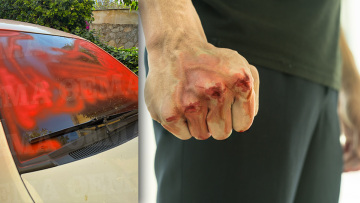  Μύκονος: Νέα επίθεση φέρεται να έκανε ο 17χρονος στην 44χρονη μητέρα του - Βανδάλισε το αυτοκίνητό της - Δείτε φωτογραφία