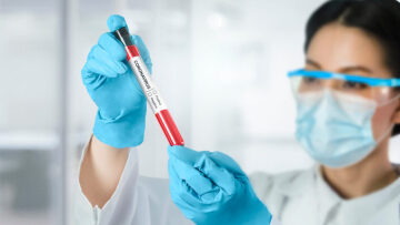 Κορωνοϊός: H Omicron «ρίχνει» στο 50% τις πιθανότητες εμφάνισης long Covid, σε αντίθεση με τη Δέλτα