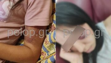 Πάτρα: Θύμα κακοποίησης 16χρονη από τον 25χρονο σύντροφό της - Έκκληση από τη μητέρα της