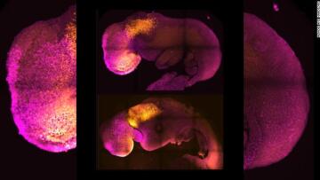 Επιστήμονες δημιούργησαν συνθετικό έμβρυο χωρίς σπερματοζωάρια και ωάρια 