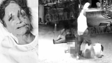 Αίγινα: Φωτογραφίες-ντοκουμέντο από τον άγριο ξυλοδαρμό του ξενοδόχου