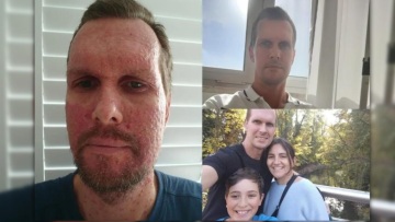 Άνδρας που διαγνώστηκε με καρκίνο 4ου σταδίου αποκαλύπτει το πρώτο προειδοποιητικό σημάδι