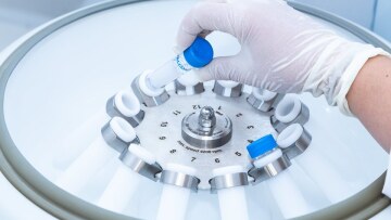 Έρευνα: Μόνο το 4% των υποψήφιων ανδρών γίνονται τελικά δεκτοί ως δωρητές σπέρματος