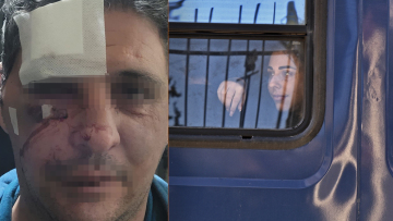 Super Κική: Της ασκήθηκε ποινική δίωξη - «Με ξυλοκόπησε επαγγελματίας» λέει ο άνδρας που την κατήγγειλε