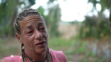 Survivor All Star - Αφροδίτη Σκαφίδα: Εσπευσμένα στο νοσοκομείο - Πρήστηκε το πρόσωπό της 
