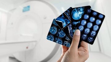 Σκλήρυνση κατά πλάκας: Ελπιδοφόρο φάρμακο από ομογενή επιστήμονα της Αυστραλίας - Κλινικές μελέτες και στην Ελλάδα