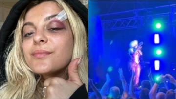 Bebe Rexha: Ο άνδρας που τη χτύπησε στο πρόσωπο με το κινητό αποκάλυψε γιατί το έκανε - «Σκέφτηκα ότι θα ήταν αστείο»