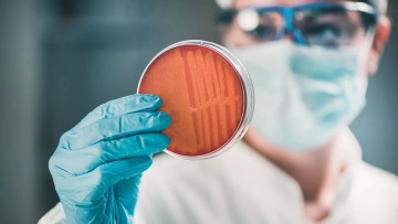Αντιβιοτικά: Η ουσία που «αποδυναμώνει» τα ανθεκτικά μικρόβια και δίνει λύση στη μικροβιακή αντοχή