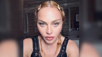 Μαντόνα: Μετά την περιπέτεια της υγείας της χορεύει στο Instagram για να γιορτάσει τα 40 χρόνια του «Lucky Star»