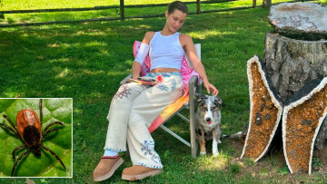 Νόσος του Lyme:  Ποια είναι η ασθένεια από την οποία πάσχει η Μπέλα Χαντίντ