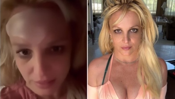 Μπρίτνεϊ Σπίαρς: «Τελείωσα με τα μπότοξ, είμαι σαν να με έχουν δείρει»