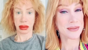 Κάθι Γκρίφιν: Σοκάρει με τα πρησμένα χείλη η ηθοποιός μετά από επέμβαση τατουάζ 