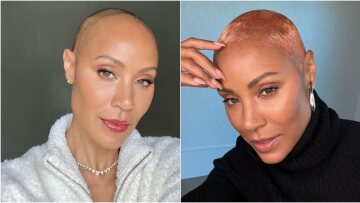 H Τζέιντα Πίνκετ Σμιθ αποκάλυψε πως το πρόβλημα της αλωπεκίας έχει βελτιωθεί σημαντικά