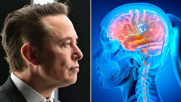 Η εταιρεία «Neuralink» του Έλον Μασκ έλαβε άδεια να δοκιμάσει εμφύτευμα εγκεφάλου σε ανθρώπους