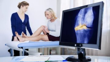 Το αποτελεσματικό αντιφλεγμονώδες που καταπολεμά τις αυτοάνοσες ρευματικές παθήσεις – Δεν είναι τρόφιμο!