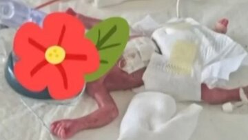 Μωράκι που γεννήθηκε πρόωρα στις 23 εβδομάδες βγήκε από τη θερμοκοιτίδα μετά από 159 ημέρες!