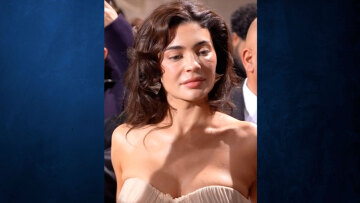 Κάιλι Τζένερ: Σάλος στο Twitter με το πρόσωπό της - Είναι 26 και μοιάζει με 40, γράφουν