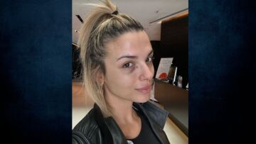 Κατερίνα Λιόλιου: Η φωτογραφία με μαυρισμένο μάτι μετά το αντικείμενο που της έριξαν επί σκηνής