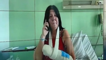 Θεσσαλονίκη: «Έχασα τον μισό εαυτό μου» λέει η 55χρονη που είδε το πίτμπουλ να κατασπαράζει το σκυλάκι της