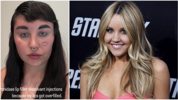 Αμάντα Μπάινς: Τρόμαξαν οι φαν της με την αλλαγή στην εμφάνισή της